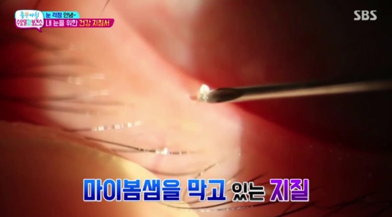 SBS صباح الخير 'الأربعاء في المركز الصحي' فيديو قناة Smile Doctor Yeom Sabu TV متاح الآن! 사진 5