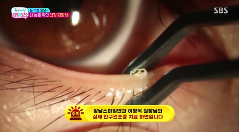 SBS صباح الخير 'الأربعاء في المركز الصحي' فيديو قناة Smile Doctor Yeom Sabu TV متاح الآن! 사진 3