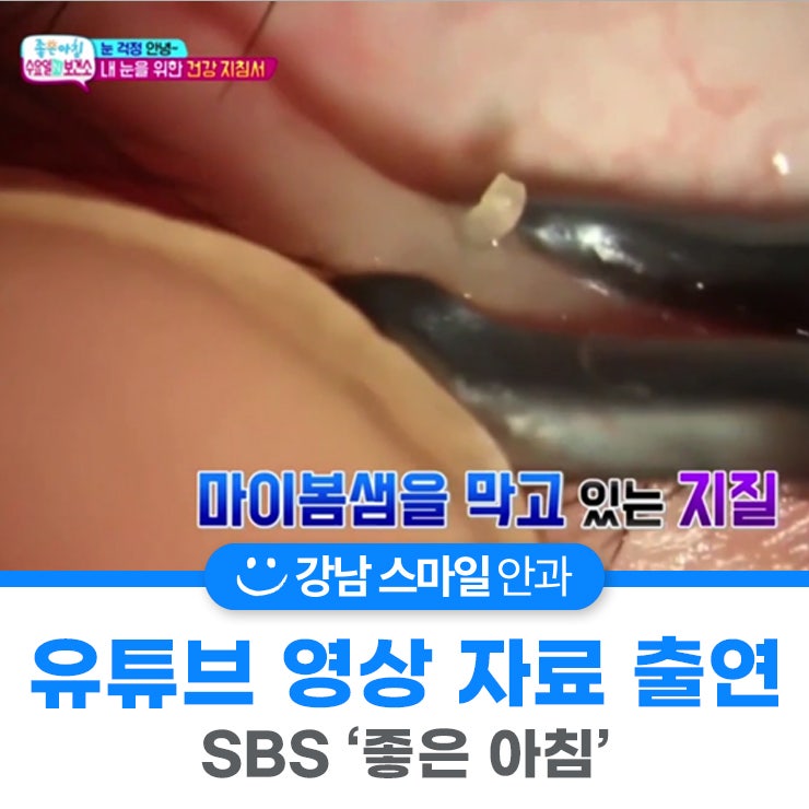 SBS صباح الخير 'الأربعاء في المركز الصحي' فيديو قناة Smile Doctor Yeom Sabu TV متاح الآن!