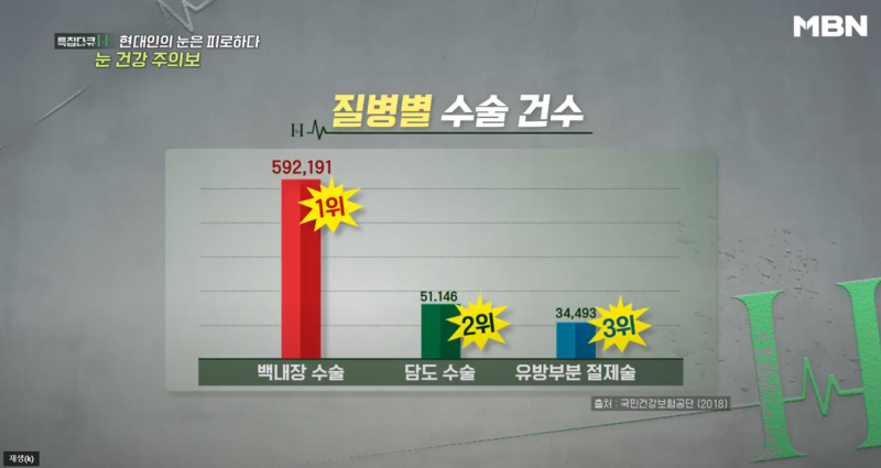 [MBN เตือนภัยสุขภาพตา] ผู้อำนวยการอี ชาง-มก จากโรงพยาบาลจักษุคังนัมสไมล์ ออกอากาศ 사진 13