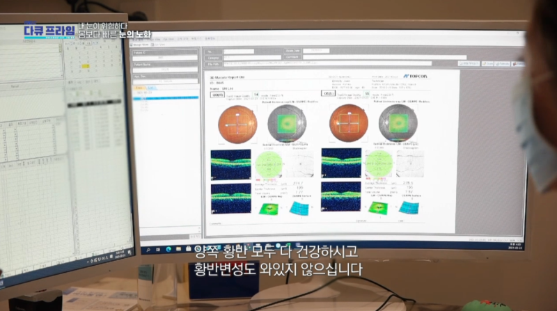 [MBC Docuprime Episode 401] Direktur Yoon Hyo-seong dari Gangnam Smile Eye Clinic Tampil di Siaran 사진 27