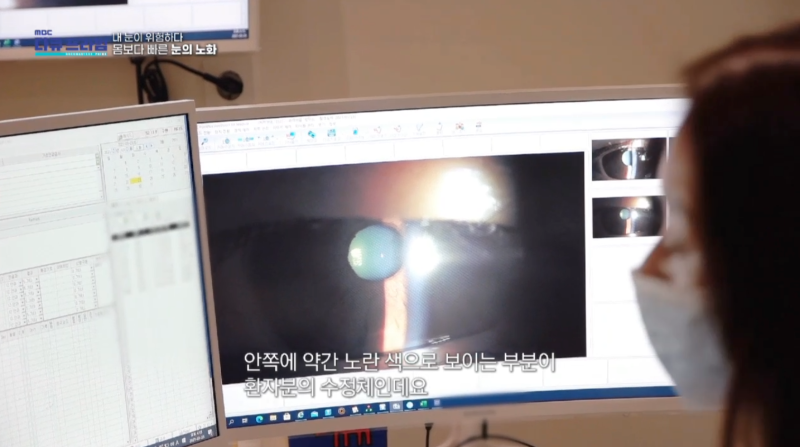 [MBC Docuprime Episode 401] Direktur Yoon Hyo-seong dari Gangnam Smile Eye Clinic Tampil di Siaran 사진 9