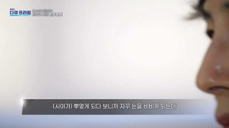 [MBC Docuprime Episode 401] Direktur Yoon Hyo-seong dari Gangnam Smile Eye Clinic Tampil di Siaran 사진 5