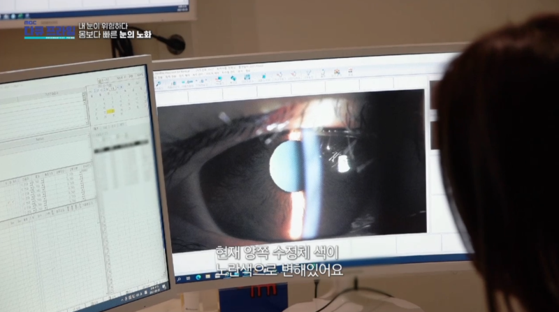 [MBC Docuprime Episode 401] Direktur Yoon Hyo-seong dari Gangnam Smile Eye Clinic Tampil di Siaran 사진 10