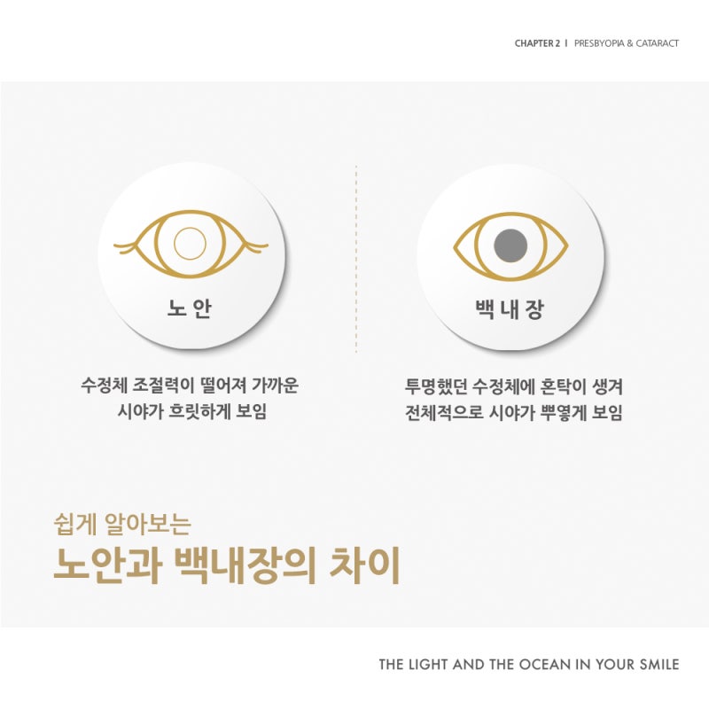 江南スマイル眼科の『助けてアイズ:老眼&白内障編』 사진 4
