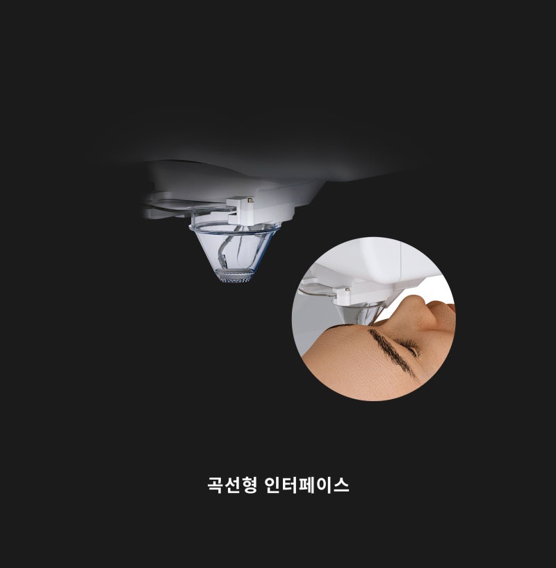 Gangnam Smile Eye Clinic Memperkenalkan Peralatan Bedah NEW SMILE LASIK Schwind ATOS! 사진 7