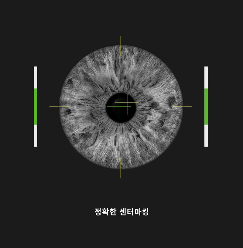 Gangnam Smile Eye Clinic Memperkenalkan Peralatan Bedah NEW SMILE LASIK Schwind ATOS! 사진 5