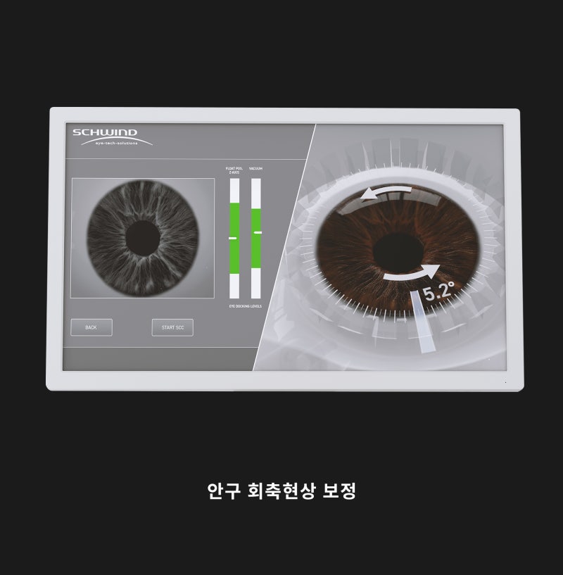 Gangnam Smile Eye Clinic Memperkenalkan Peralatan Bedah NEW SMILE LASIK Schwind ATOS! 사진 6