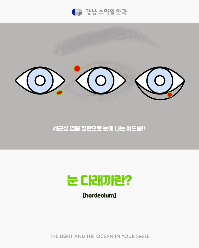 如果您正在尋找江南站治療針眼的好地方？