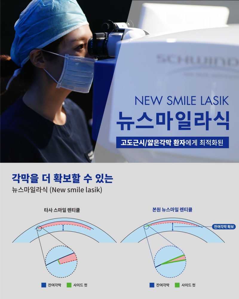 حول فعالية وسلامة عملية New Smile LASIK في عيادة جانجنام سمايل لطب العيون 사진 7