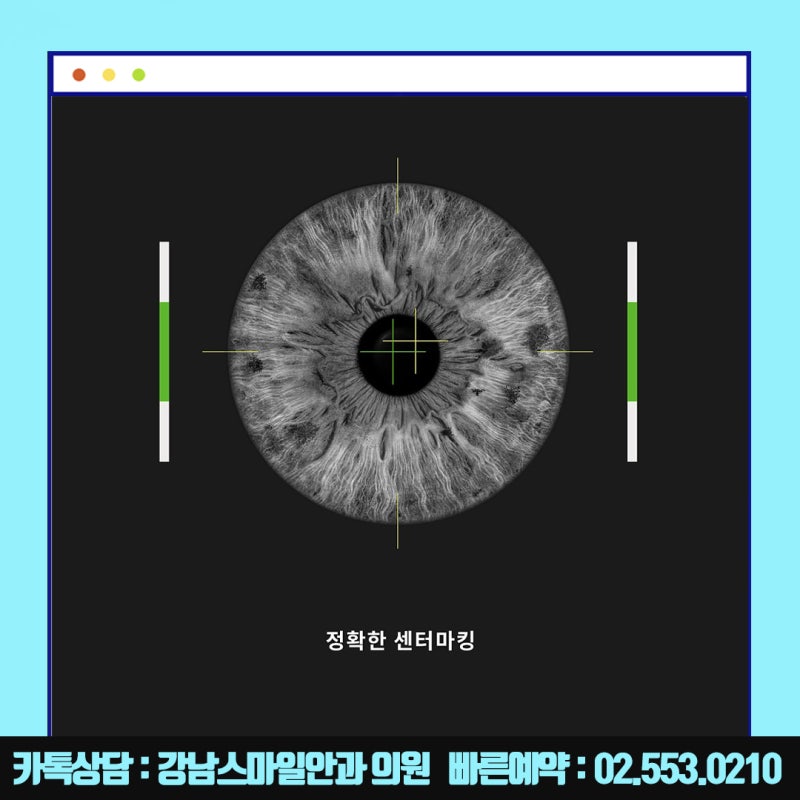 جراحة نيوسمايل في سيول، عيادة جانجنام سمايل للعيون المشهورة بـ LASIK و LASEK :) 사진 10