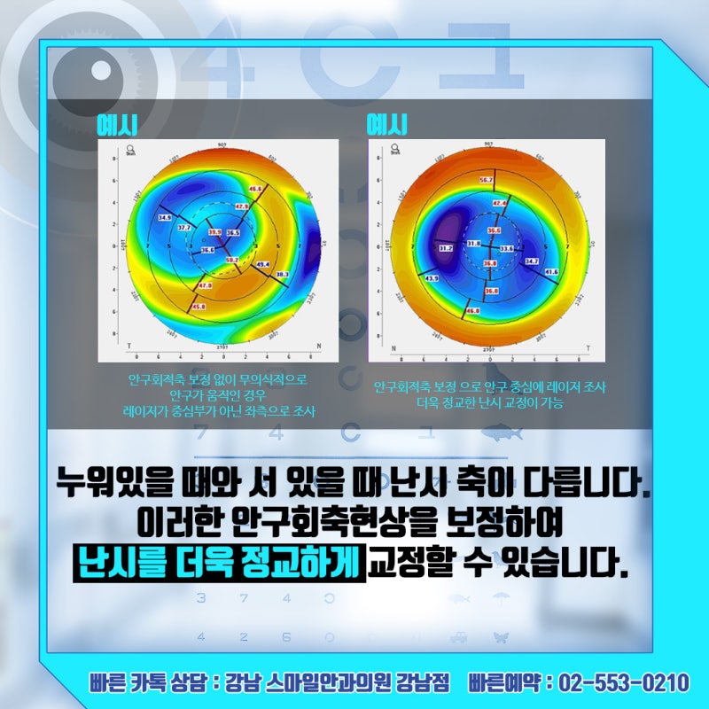 رؤية جديدة، استشارة حول سعر عملية Newsmile Lasik في عيادة جانجنام سمايل لطب العيون 사진 20