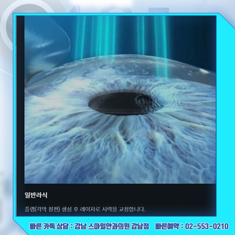 رؤية جديدة، استشارة حول سعر عملية Newsmile Lasik في عيادة جانجنام سمايل لطب العيون 사진 11