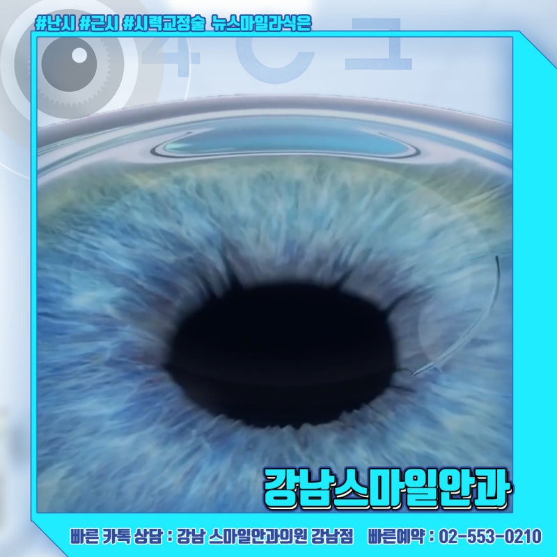 رؤية جديدة، استشارة حول سعر عملية Newsmile Lasik في عيادة جانجنام سمايل لطب العيون