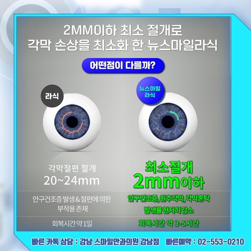 رؤية جديدة، استشارة حول سعر عملية Newsmile Lasik في عيادة جانجنام سمايل لطب العيون 사진 18