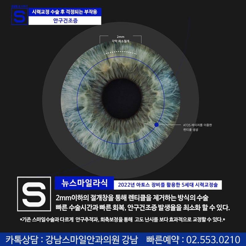 هل تقلق بشأن الآثار الجانبية بعد جراحة تصحيح البصر بالليزر (LASIK, LASEK)؟ #جفاف_العين #توسع_القرنية 사진 7
