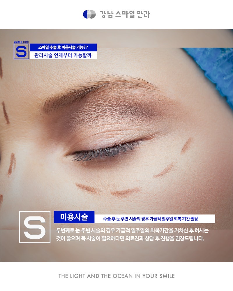 أريد إجراء عملية سمايل وعلاجات تجميلية أيضًا!! ماذا أفعل؟ 사진 5