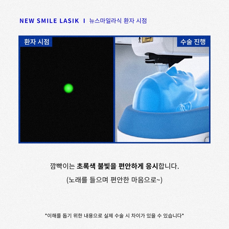 New SMILE手术患者视角(第一人称) 사진 3