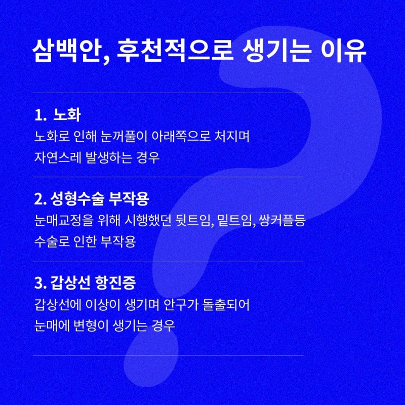 [瞳孔整形手术 Eye Ring] 如果您正在为三白眼、四白眼而烦恼？ 사진 3