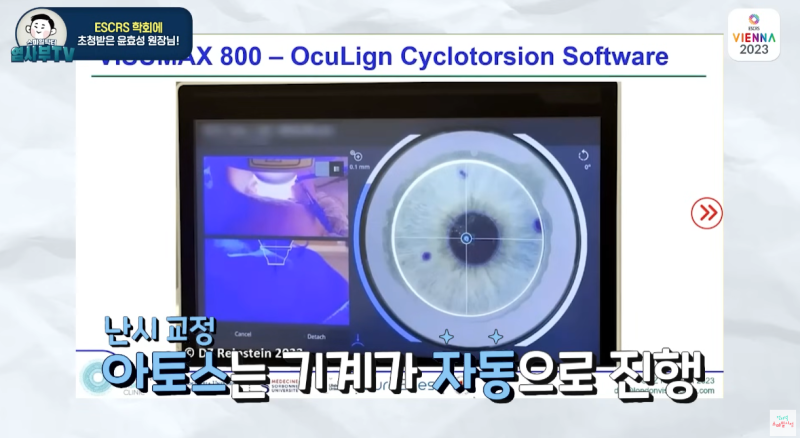 [5-р үеийн LASIK] Smart vs. SMILE Pro: Астигматизмыг засахад аль нь илүү сайн бэ? 사진 13