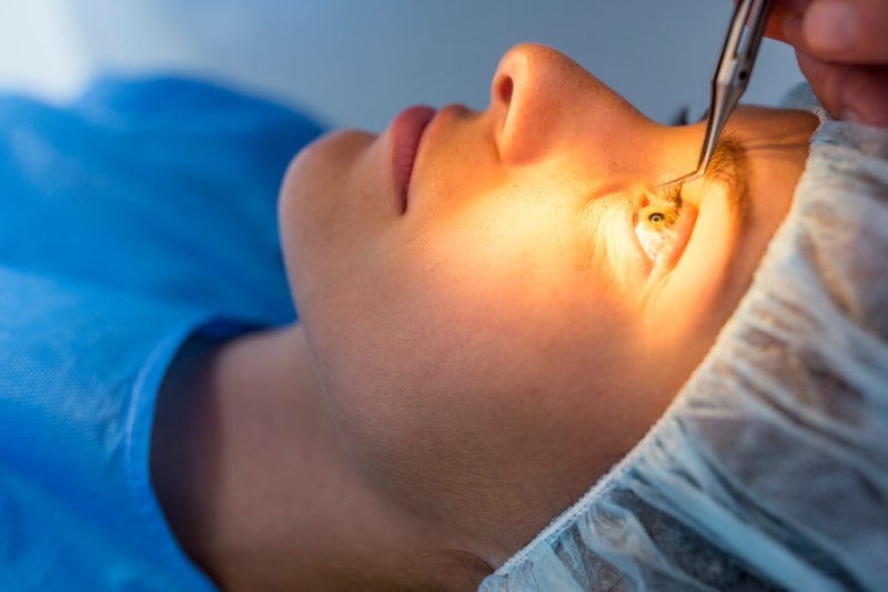 LASIK กับการผ่าตัดตาสองชั้น อะไรควรทำก่อน? + ระยะเวลาพักฟื้น LASIK และตาสองชั้น 사진 4