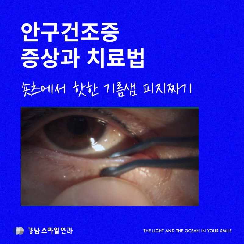 안구건조증 증상에 따른 치료법 (Feat. 피지 짜기 숏츠, 온찜질하는 법)