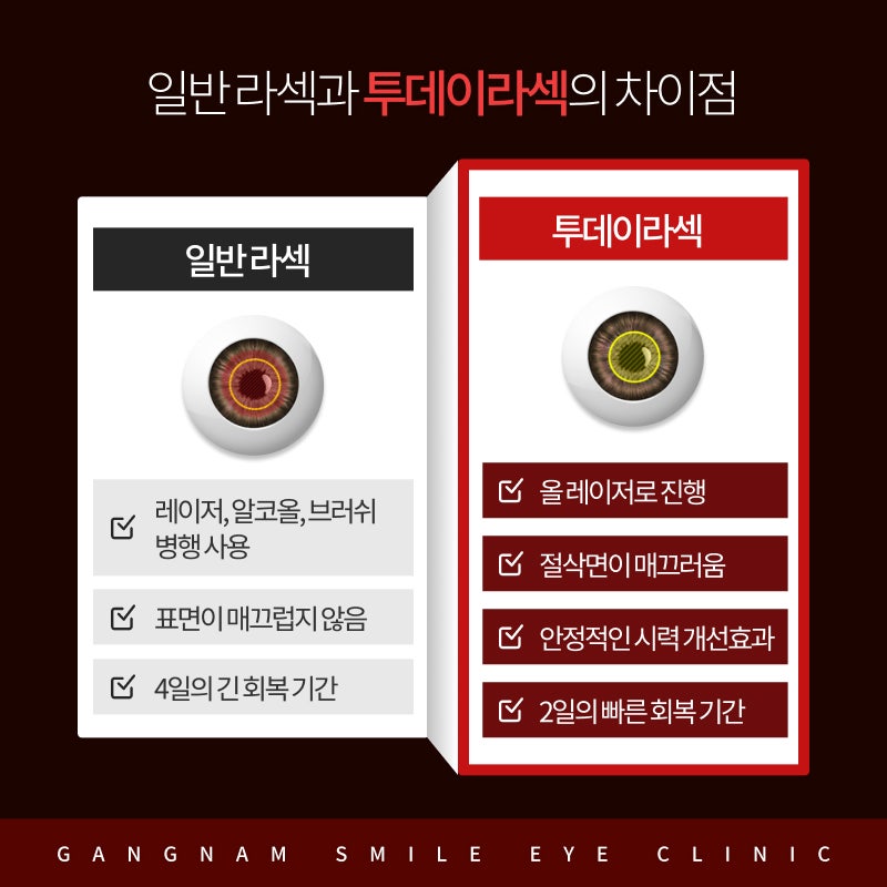 Gangnam Today LASEK, Apa Keunggulannya Dibanding LASEK Biasa? Cari Tahu Perbedaannya