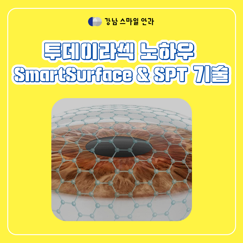LASEK Today Gangnam Station dengan Pemulihan Cepat, Apa itu Teknologi SmartSurface & SPT?
