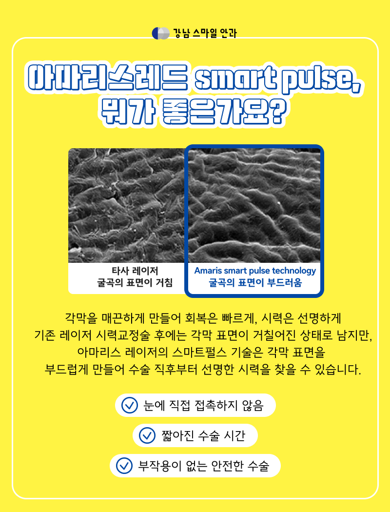 LASEK Today Gangnam Station dengan Pemulihan Cepat, Apa itu Teknologi SmartSurface & SPT? 사진 4
