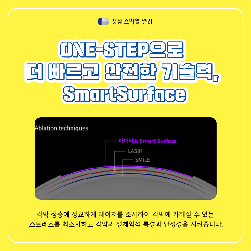 การทำ Today LASEK ที่สถานีกังนัม ฟื้นตัวเร็ว ด้วยเทคโนโลยี SmartSurface & SPT คืออะไร?