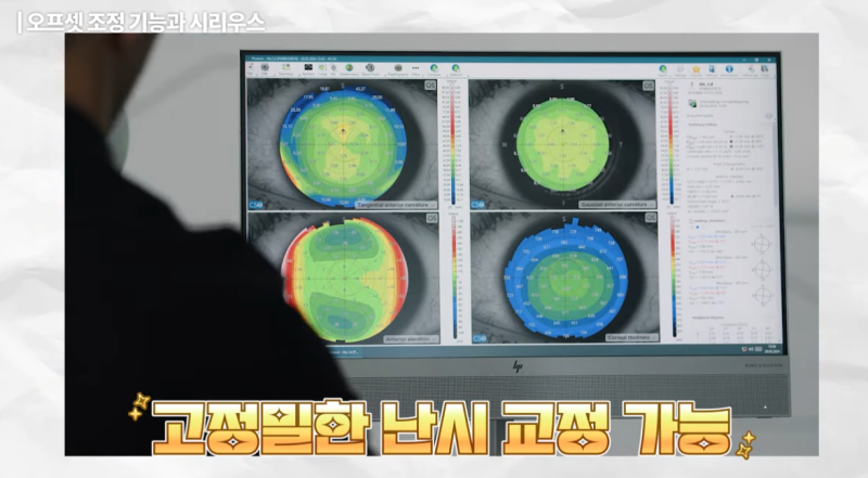 스마일라식부작용 줄이는 법, 빛번짐 줄이는 법 사진 8