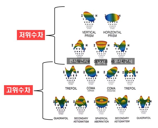 스마일라식부작용 줄이는 법, 빛번짐 줄이는 법 사진 4