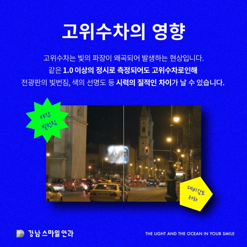 스마일라식부작용 줄이는 법, 빛번짐 줄이는 법 사진 5