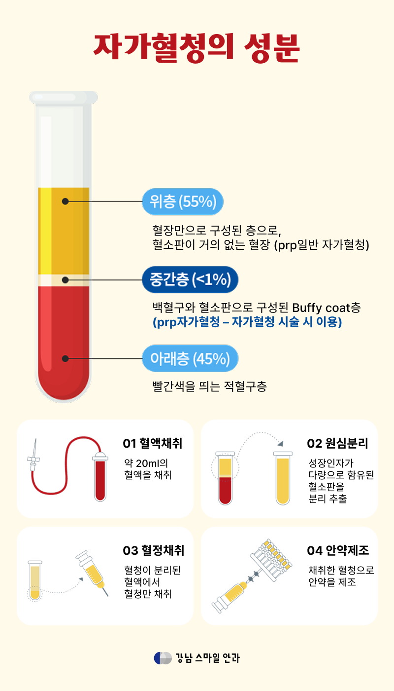 แนะนำจักษุแพทย์สถานีกังนัม | ตาแห้งหลังทำเลสิก, ยาหยอดตาที่จำเป็นสำหรับการฟื้นตัวอย่างรวดเร็ว 사진 2
