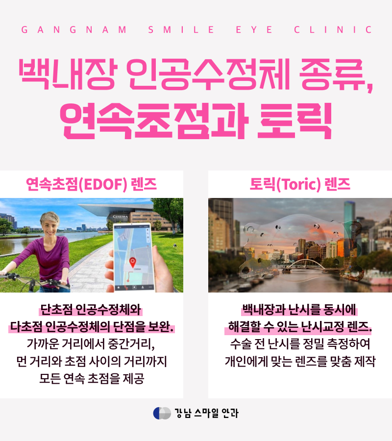 ประเภทเลนส์ต้อกระจก | เลนส์ชั้นเดียว, เลนส์หลายชั้น, เลนส์โฟกัสต่อเนื่อง, เลนส์ Toric แตกต่างกันอย่างไร? | การผ่าตัดสายต