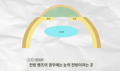ค่าใช้จ่ายในการผ่าตัดฝังเลนส์ | ทำไมถึงแพงจัง? ทุกสิ่งเกี่ยวกับการผ่าตัดฝังเลนส์ A ถึง Z 사진 4