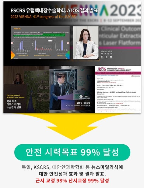 สรุปประเภทการผ่าตัดแก้ไขสายตาที่โรงพยาบาลจักษุคังนัมสเตชั่น! 사진 7