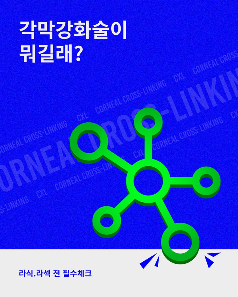 什么是角膜强化术,如何预防视力退化? | 江南站眼科