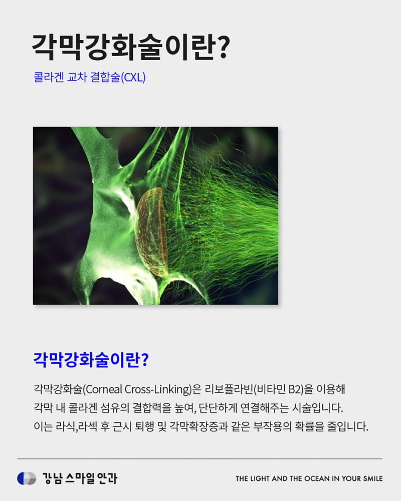 什么是角膜强化术,如何预防视力退化? | 江南站眼科 사진 2