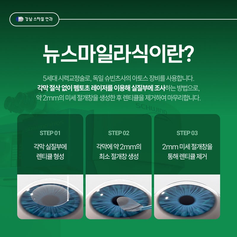 스마일라식 성공을 좌우하는 기준은 뭘까? 강남스마일안과 사진 2