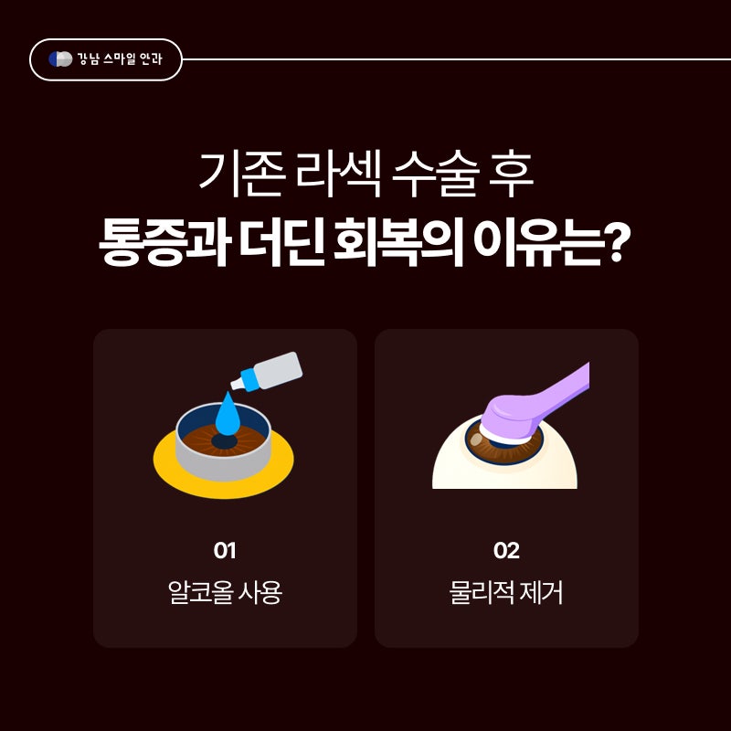 고도근시를 위한 투데이라섹이란? 라섹통증 차이 | 강남역안과
