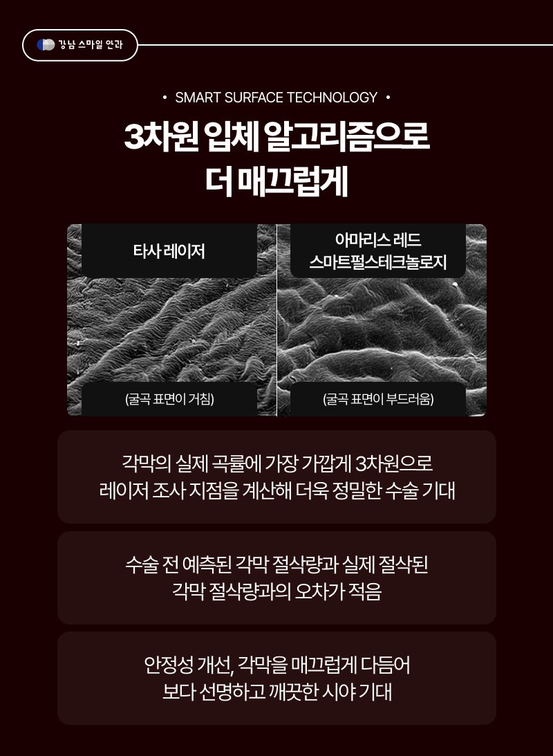 고도근시를 위한 투데이라섹이란? 라섹통증 차이 | 강남역안과 사진 4