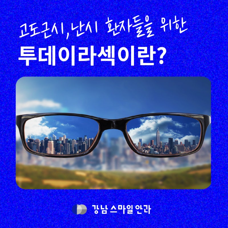 고도근시를 위한 투데이라섹이란? 라섹통증 차이 | 강남역안과