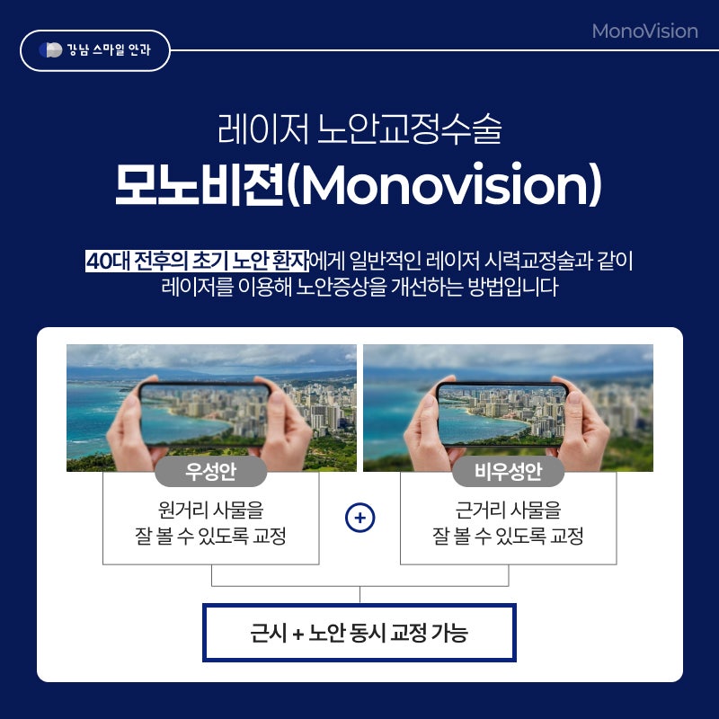 백내장은 없지만 눈이 흐릴 때 좋은 노안라식, 모노비전라식이란? 사진 3