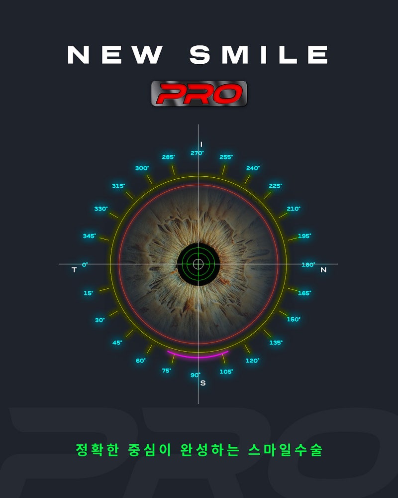 ความแตกต่างของ New SMILE PRO | แตกต่างจาก New SMILE LASIK เดิมอย่างไร? 사진 3