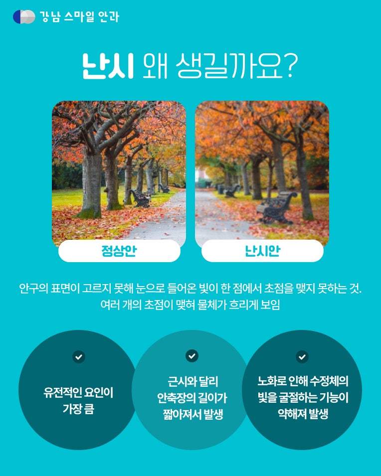 สายตาสั้นมาก, สายตาเอียงมาก แนะนำทำ Smile LASIK ได้หรือไม่? 사진 2