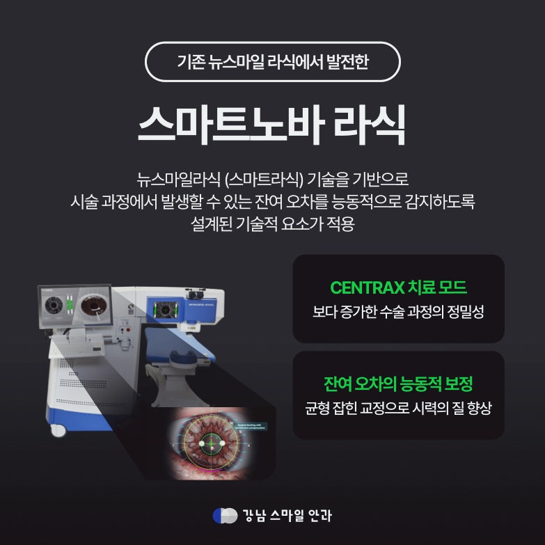 หากคุณกำลังพิจารณาการแก้ไขสายตาเอียง? ให้ความสนใจกับ Smart Nova LASIK ที่ Seocho Dongsan Eye Clinic 사진 2