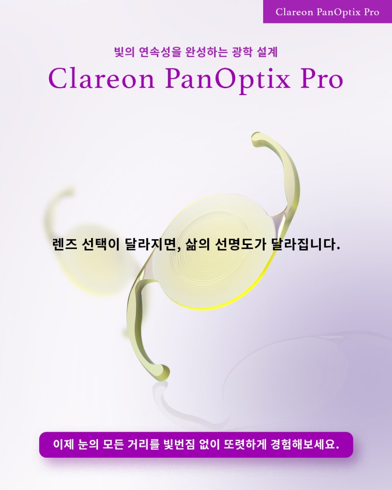 เลนส์แก้วตาเทียมแบบมัลติโฟกัสระดับพรีเมียมรุ่นใหม่: Clareon PanOptix Pro 사진 6