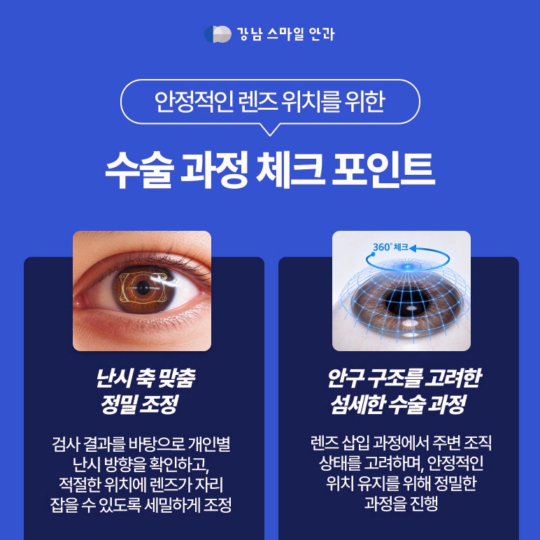 Why is the medical team important for a successful implantable collamer lens surgery? 사진 2
