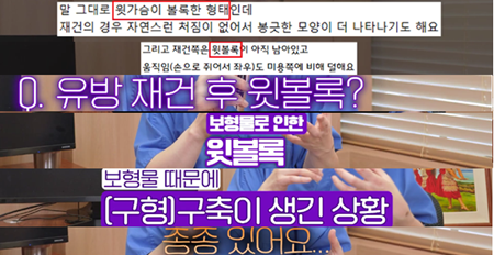 <신유외과> 유방재건수술 후 윗볼록이 생긴 원인과 해결방법!